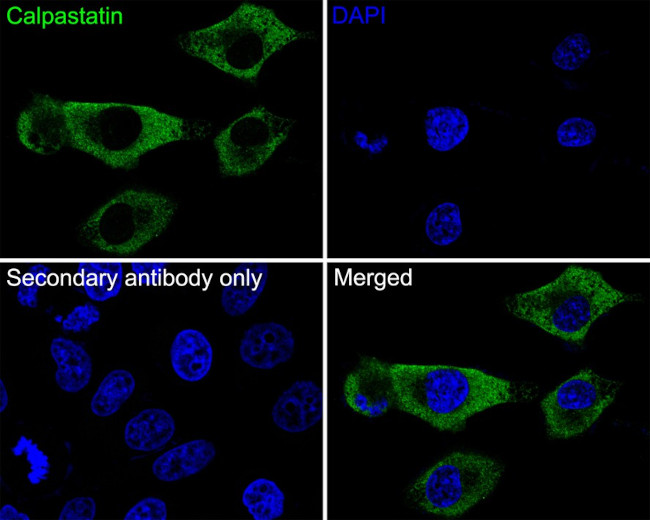 Calpastatin Antibody in Immunocytochemistry (ICC/IF)