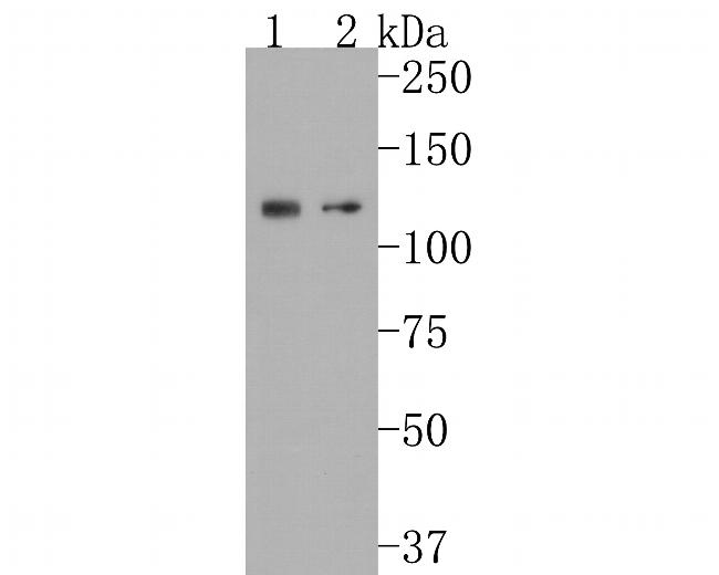 Calpastatin Antibody in Western Blot (WB)
