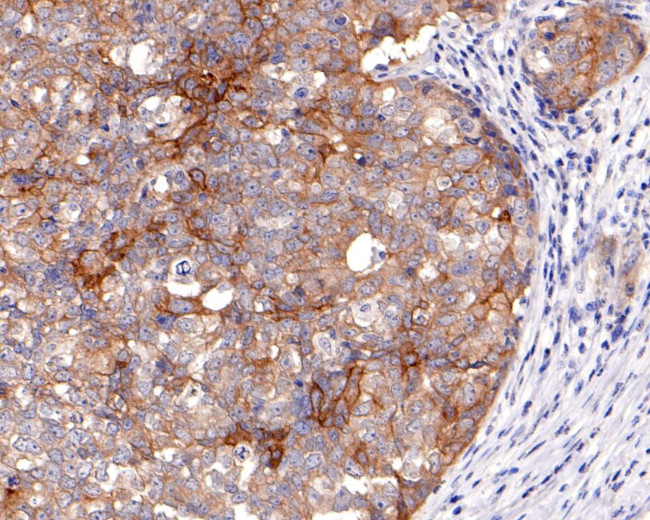 TROP2 Antibody in Immunohistochemistry (Paraffin) (IHC (P))