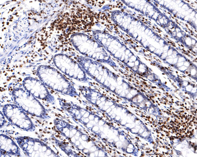 RUNX3 Antibody in Immunohistochemistry (Paraffin) (IHC (P))