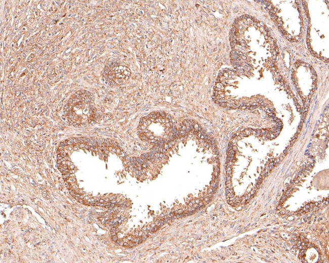 IL11RA Antibody in Immunohistochemistry (Paraffin) (IHC (P))