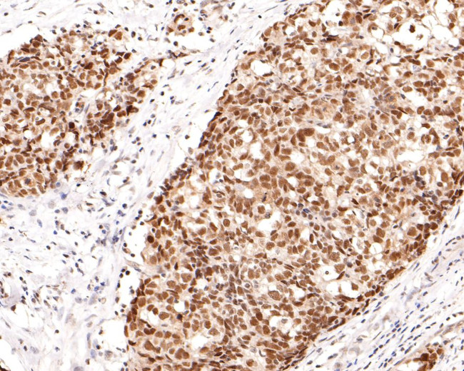 NCoR1 Antibody in Immunohistochemistry (Paraffin) (IHC (P))