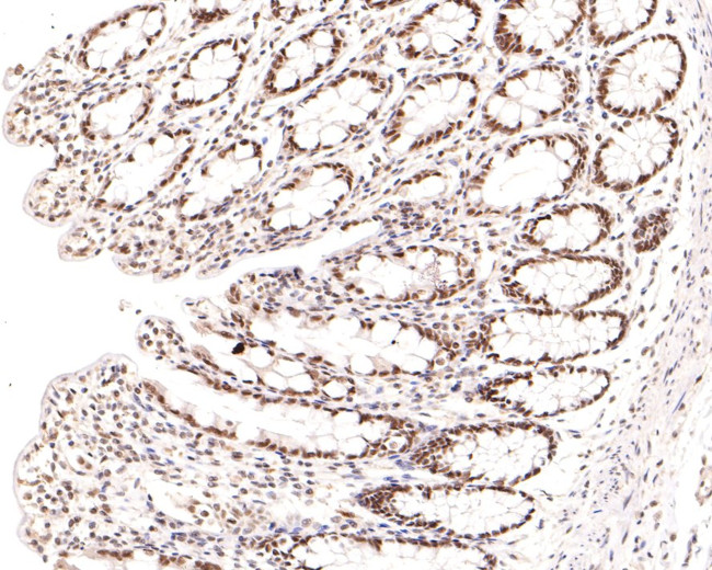 NCoR1 Antibody in Immunohistochemistry (Paraffin) (IHC (P))