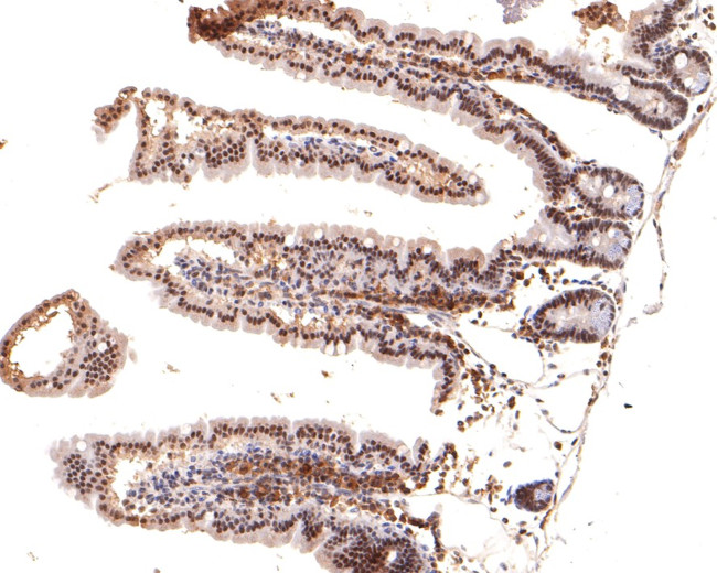 NCoR1 Antibody in Immunohistochemistry (Paraffin) (IHC (P))