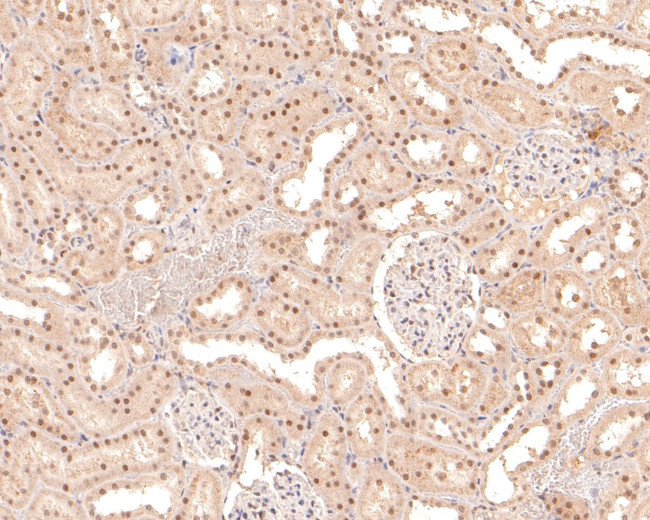 NCoR1 Antibody in Immunohistochemistry (Paraffin) (IHC (P))