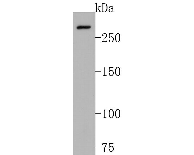 NCoR1 Antibody in Western Blot (WB)