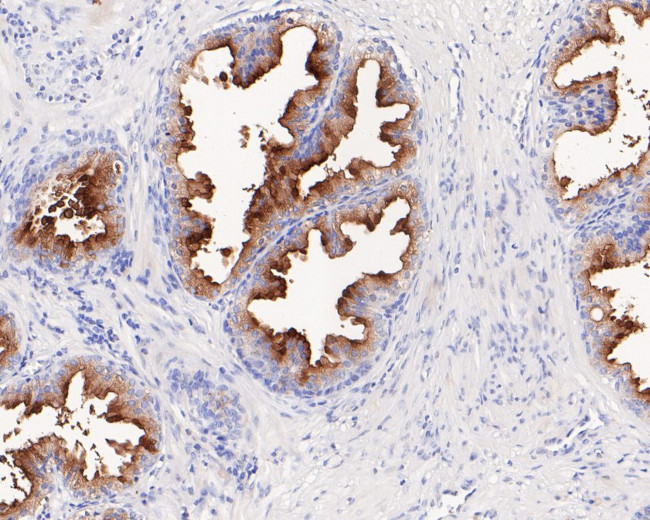 PSMA Antibody in Immunohistochemistry (Paraffin) (IHC (P))