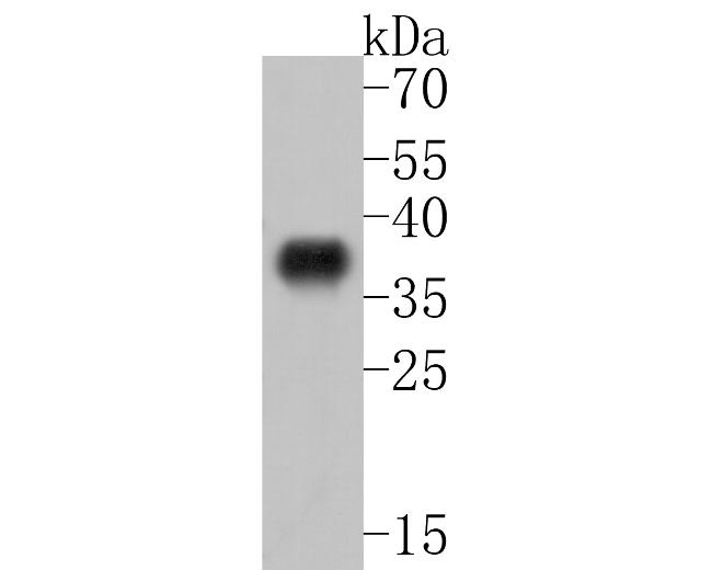 ABHD3 Antibody in Western Blot (WB)