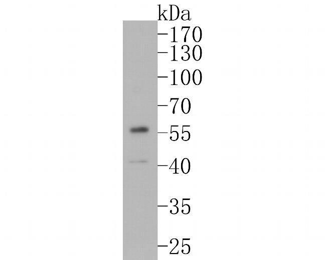 FOXA1 Antibody in Western Blot (WB)