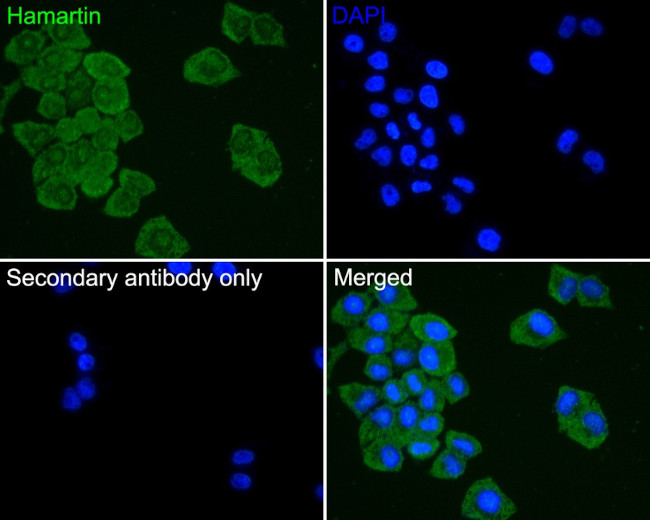 TSC1 Antibody in Immunocytochemistry (ICC/IF)