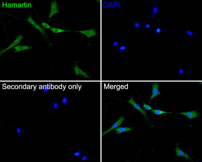 TSC1 Antibody in Immunocytochemistry (ICC/IF)