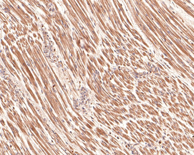 TSC1 Antibody in Immunohistochemistry (Paraffin) (IHC (P))