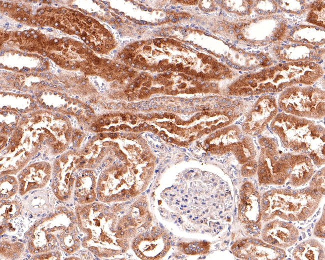 TSC1 Antibody in Immunohistochemistry (Paraffin) (IHC (P))