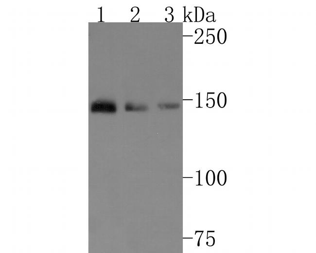 TSC1 Antibody in Western Blot (WB)