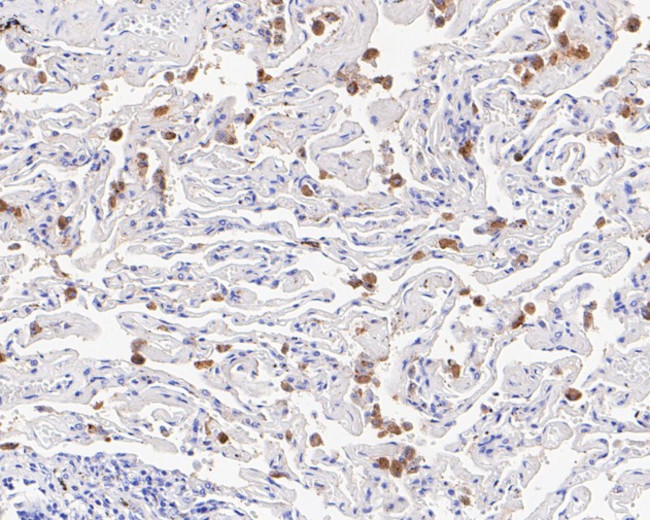 Cathepsin D Antibody in Immunocytochemistry (ICC/IF)