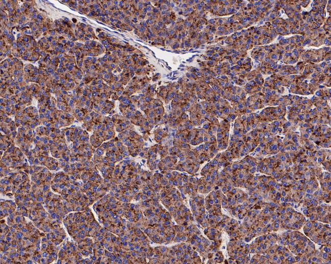 Cathepsin D Antibody in Immunohistochemistry (Paraffin) (IHC (P))