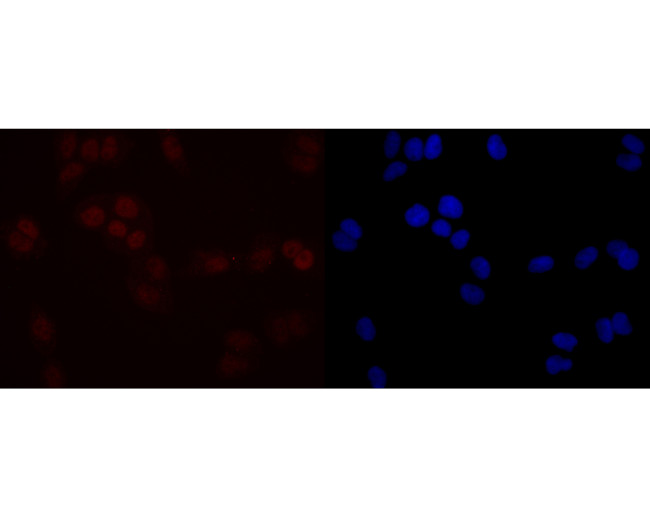 SIRT1 Antibody in Immunocytochemistry (ICC/IF)