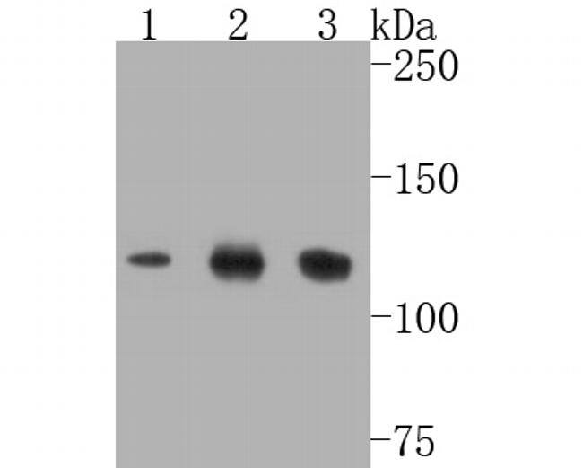 SIRT1 Antibody in Western Blot (WB)