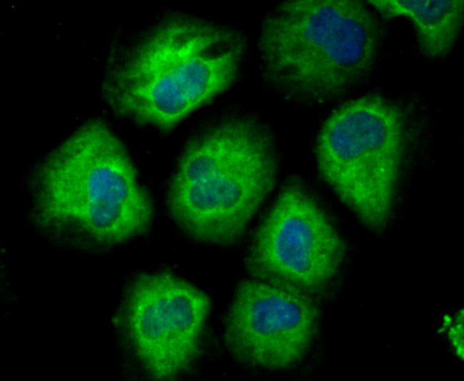 CD146 Antibody in Immunocytochemistry (ICC/IF)