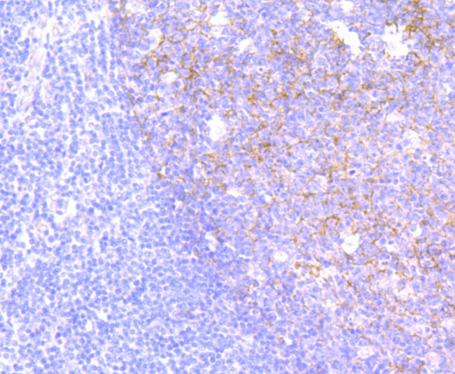 CD146 Antibody in Immunohistochemistry (Paraffin) (IHC (P))