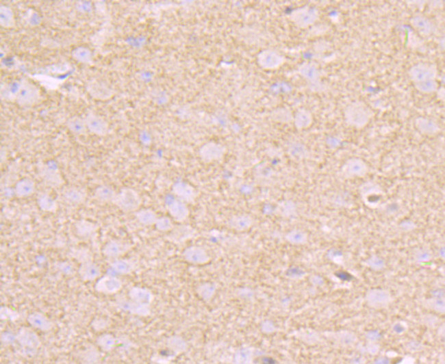 CD146 Antibody in Immunohistochemistry (Paraffin) (IHC (P))