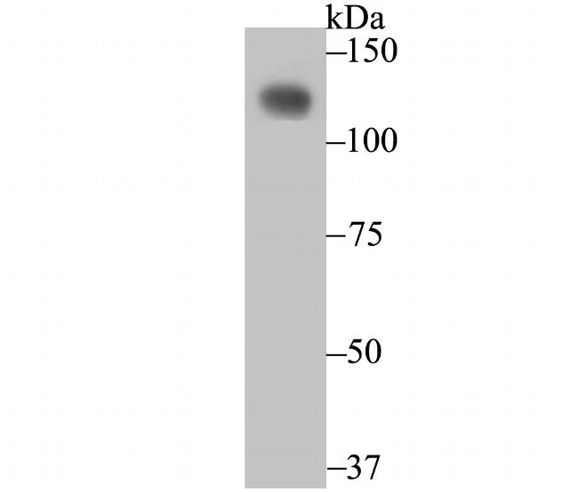 CD146 Antibody in Western Blot (WB)