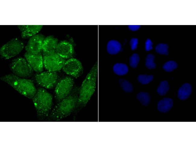 alpha Synuclein Antibody in Immunocytochemistry (ICC/IF)