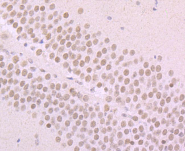 alpha Synuclein Antibody in Immunohistochemistry (Paraffin) (IHC (P))