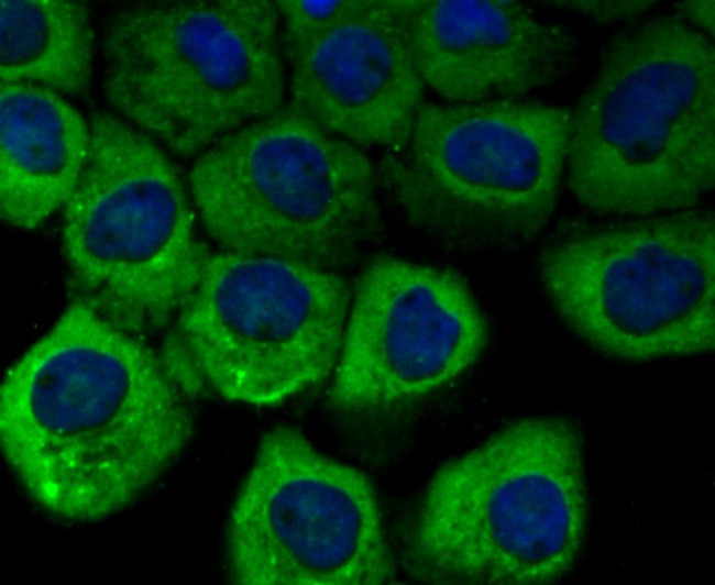 Vinculin Antibody in Immunocytochemistry (ICC/IF)