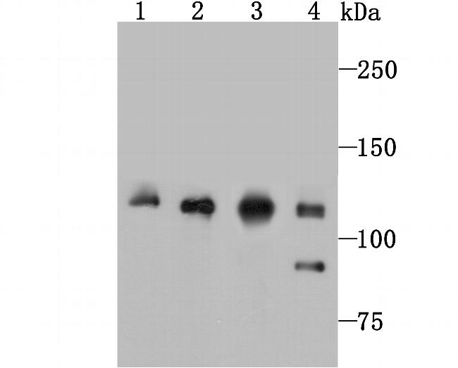 Vinculin Antibody in Western Blot (WB)