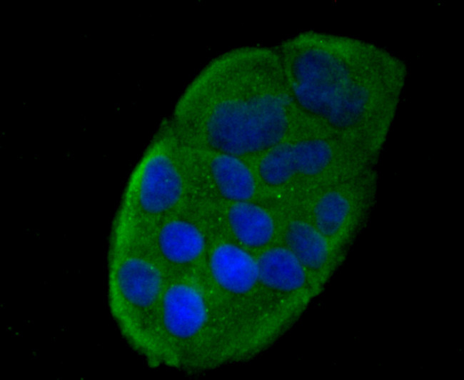 CCL5 (RANTES) Antibody in Immunocytochemistry (ICC/IF)