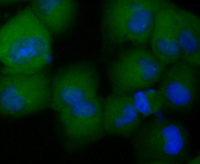 CCL5 (RANTES) Antibody in Immunocytochemistry (ICC/IF)