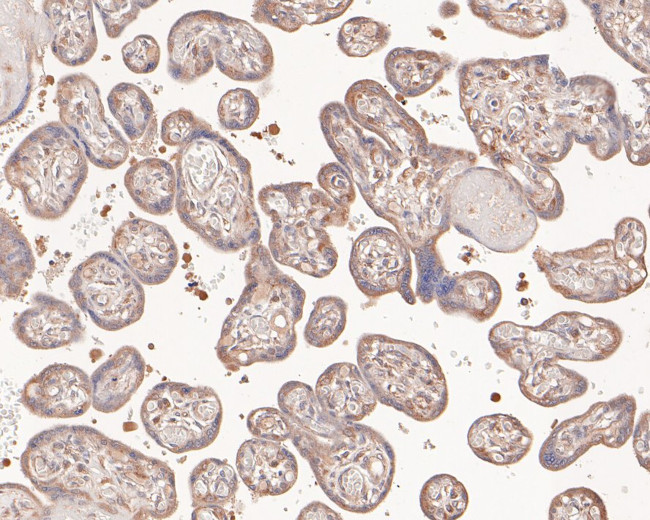 CCL5 (RANTES) Antibody in Immunohistochemistry (Paraffin) (IHC (P))