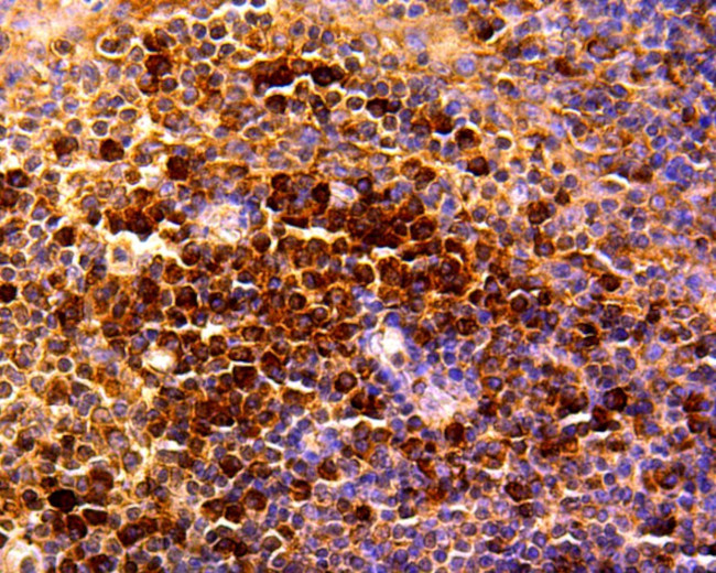 CCL5 (RANTES) Antibody in Immunohistochemistry (Paraffin) (IHC (P))