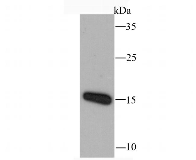 CCL5 (RANTES) Antibody in Western Blot (WB)