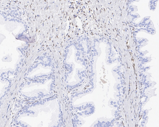 FGF2 Antibody in Immunohistochemistry (Paraffin) (IHC (P))