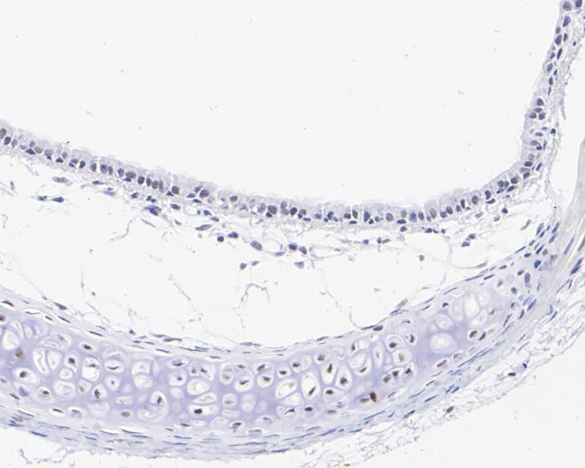 FGF2 Antibody in Immunohistochemistry (Paraffin) (IHC (P))