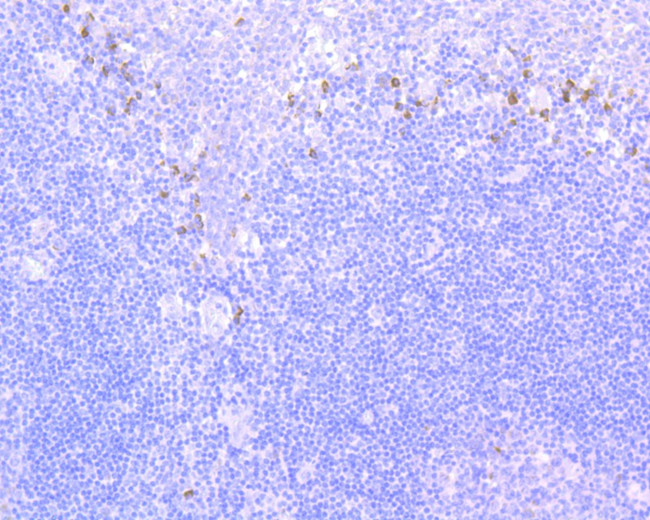 CD56 (NCAM) Antibody in Immunohistochemistry (Paraffin) (IHC (P))