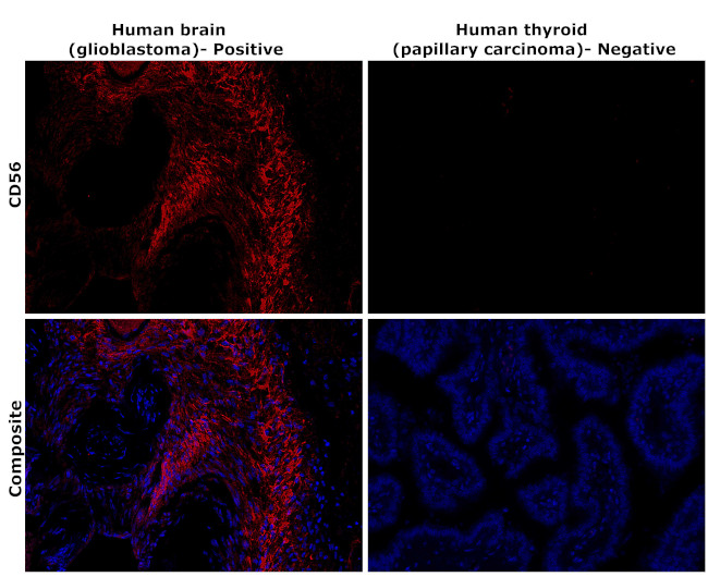 CD56 (NCAM) Antibody in Immunohistochemistry (Paraffin) (IHC (P))