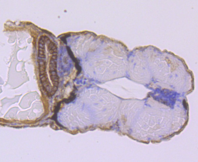 CD56 (NCAM) Antibody in Immunohistochemistry (Paraffin) (IHC (P))