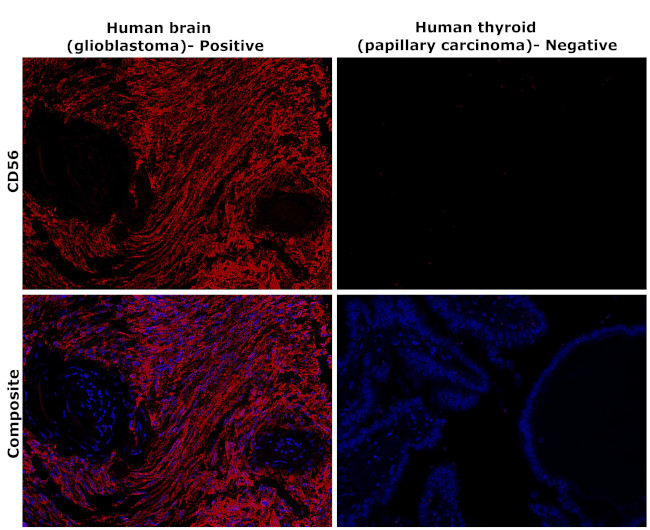 CD56 (NCAM) Antibody in Immunohistochemistry (Paraffin) (IHC (P))