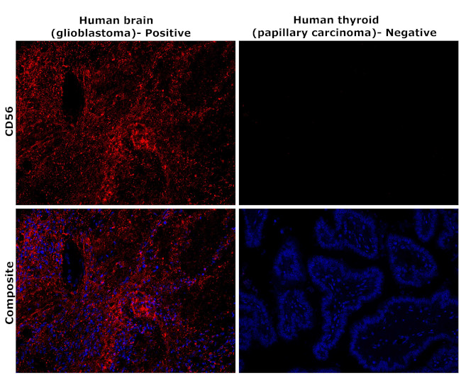 CD56 (NCAM) Antibody in Immunohistochemistry (Paraffin) (IHC (P))