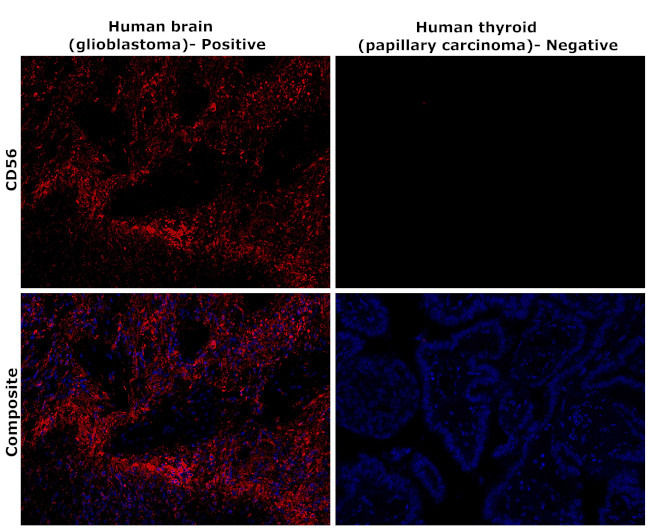 CD56 (NCAM) Antibody in Immunohistochemistry (Paraffin) (IHC (P))