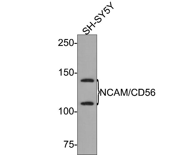 CD56 (NCAM) Antibody in Western Blot (WB)