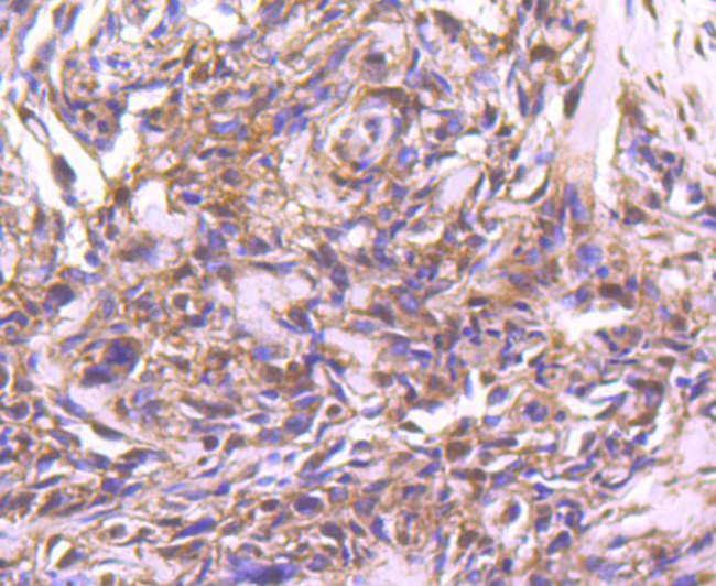 STAT4 Antibody in Immunohistochemistry (Paraffin) (IHC (P))