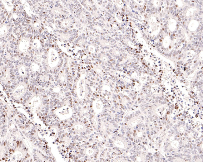 STAT4 Antibody in Immunohistochemistry (Paraffin) (IHC (P))