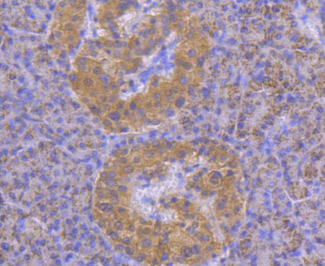 STAT4 Antibody in Immunohistochemistry (Paraffin) (IHC (P))