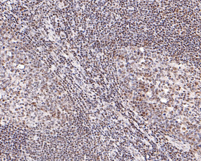 STAT4 Antibody in Immunohistochemistry (Paraffin) (IHC (P))