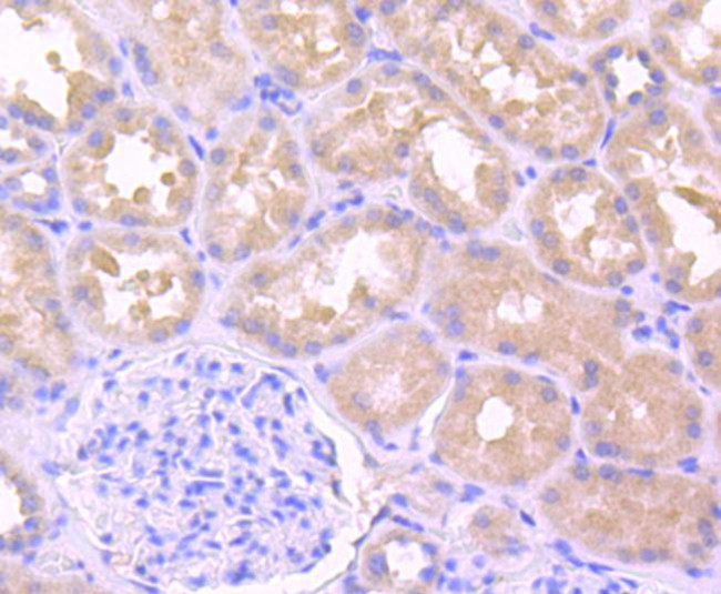 IL-1 beta Antibody in Immunohistochemistry (Paraffin) (IHC (P))