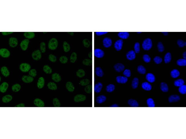 JunD Antibody in Immunocytochemistry (ICC/IF)